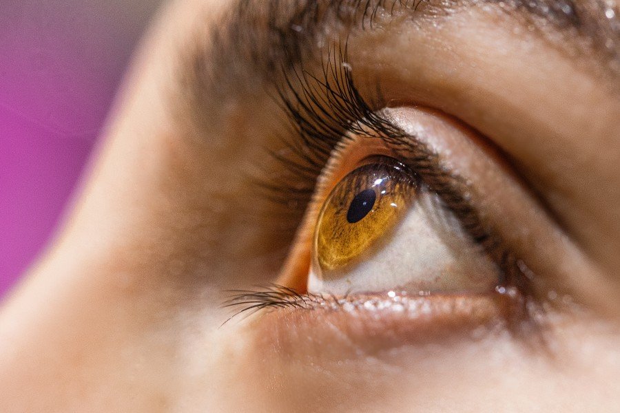 Best Doctor for Keratoconus Treatment in Gurgaon