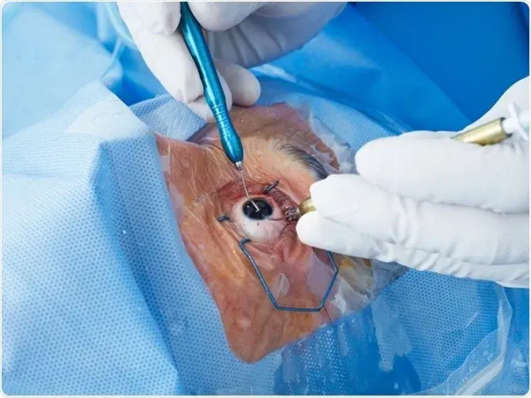 eye_surgery eye_surgery